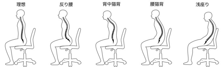 腰痛・肩こりにおける不良座位とは